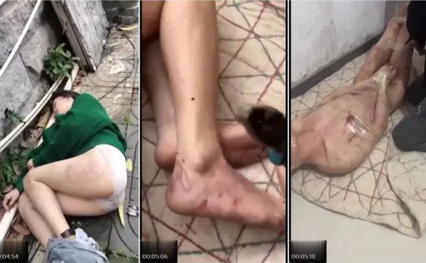 【网曝黑料】真实缅北活埋殴打强J，沙人电击等合集-王老师吃瓜