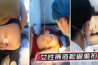 【自拍偷拍】女性痔疮检查偷拍国内某小诊所女性痔疮检查治疗多位大屁股女性被偸拍大夫居然是男的一指使劲往菊花里捅紧张的腿直抖紧紧抓着护栏_